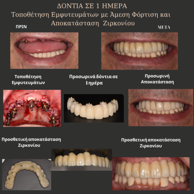 Παρατηρείτε αιμορραγία των ούλων κατά τη διάρκεια του βουρτσίσματος? - 13