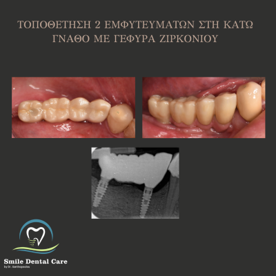ΠΡΙΝ - 3