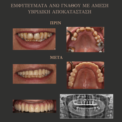 ΠΡΙΝ - 4