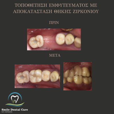 ΠΡΙΝ - 2
