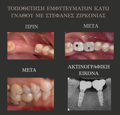 3_ΕΜΦΥΤΕΥΜΑΤΑ
