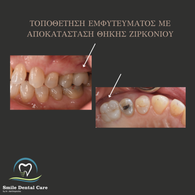 ΠΡΙΝ - 2