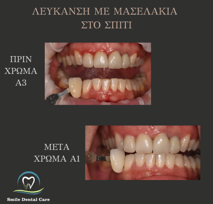 ΛΕΥΚΑΝΣΗ-ΣΠΙΤΙΟΥ-ΜΕ-ΜΑΣΕΛΑΚΙΑ