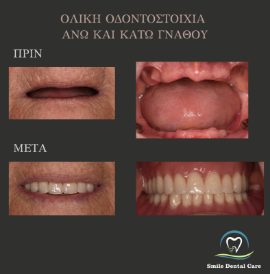 ΟΛΙΚΗ-ΟΔΟΝΤΟΣΤΟΙΧΙΑ