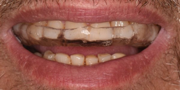 αντωνιαδησ-τιμολ