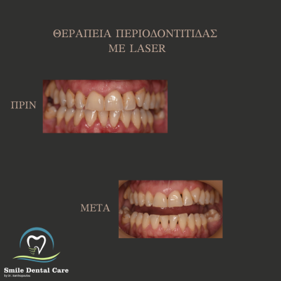 ΠΡΙΝ - 2