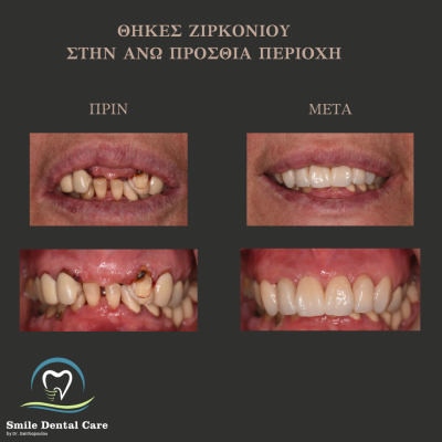 ΠΡΙΝ - 6